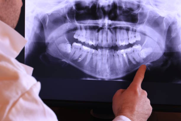 Best Emergency Dentist for Knocked-Out Tooth in Audubon, IA